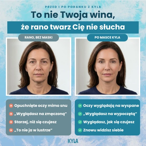 Przed i po porannej masce KYLA – to nie Twoja wina, że rano twarz Cię nie słucha